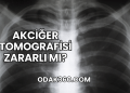 Akciğer Tomografisi Zararlı mı?