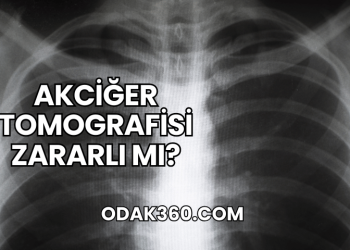 Akciğer Tomografisi Zararlı mı?