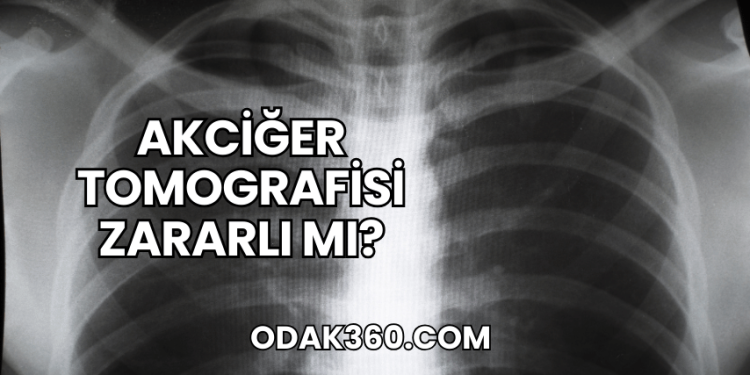 Akciğer Tomografisi Zararlı mı?