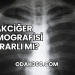 Akciğer Tomografisi Zararlı mı?
