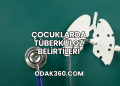 Çocuklarda Tüberküloz Belirtileri