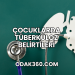Çocuklarda Tüberküloz Belirtileri