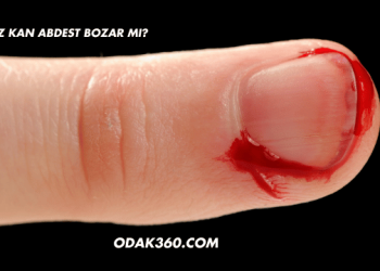 Az Kan Abdest Bozar mı?