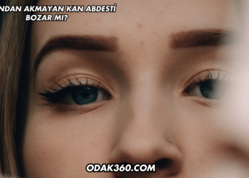 Burundan Akmayan Kan Abdesti Bozar mı?