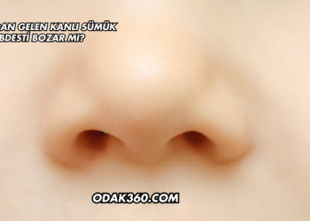 Burundan Gelen Kanlı Sümük Abdesti Bozar mı?