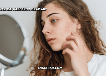 Çok Az Kan Abdesti Bozar mı?