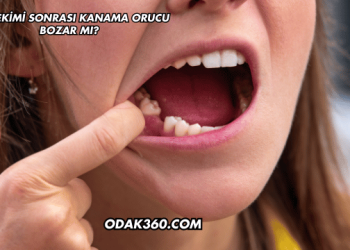 Diş Çekimi Sonrası Kanama Orucu Bozar mı?