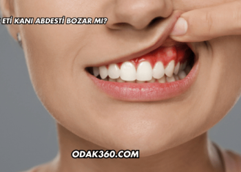 Diş Eti Kanı Abdesti Bozar mı?