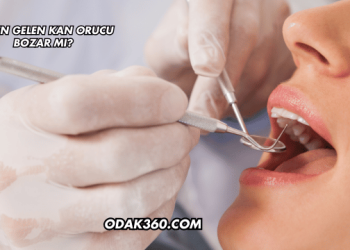 Dişten Gelen Kan Orucu Bozar mı?