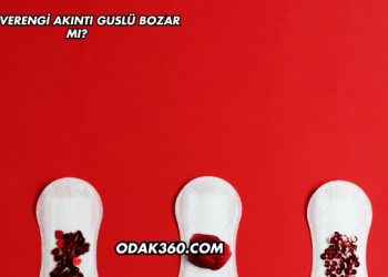 Kahverengi Akıntı Guslü Bozar mı?