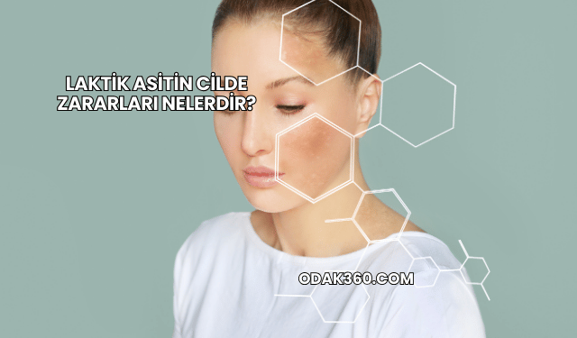 Laktik Asitin Cilde Zararları Nelerdir?