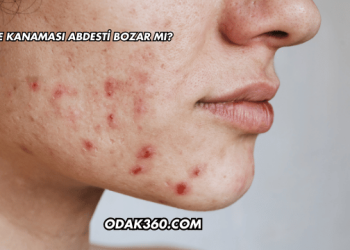 Sivilce Kanaması Abdesti Bozar mı?