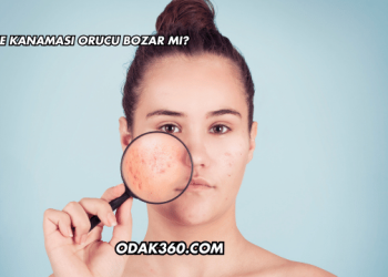 Sivilce Kanaması Orucu Bozar mı?