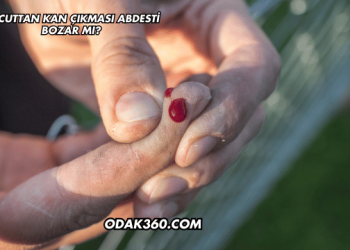 Vücuttan Kan Çıkması Abdesti Bozar mı?